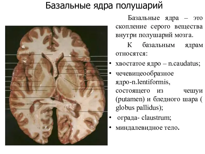 Базальные ядра полушарий Базальные ядра – это скопление серого вещества внутри