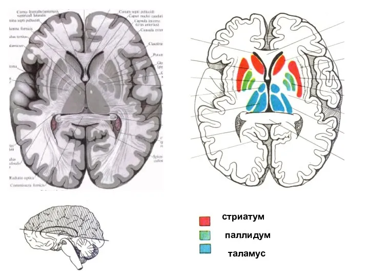 стриатум паллидум таламус