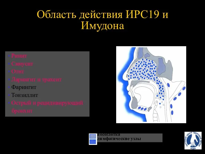 Ринит Синусит Отит Ларингит и трахеит Фарингит Тонзиллит Острый и рецидивирующий