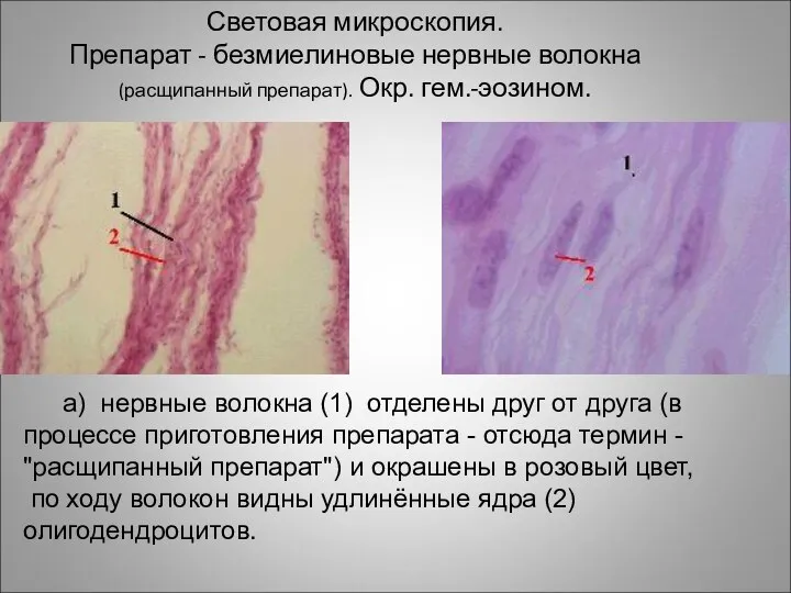 Световая микроскопия. Препарат - безмиелиновые нервные волокна (расщипанный препарат). Окр. гем.-эозином.