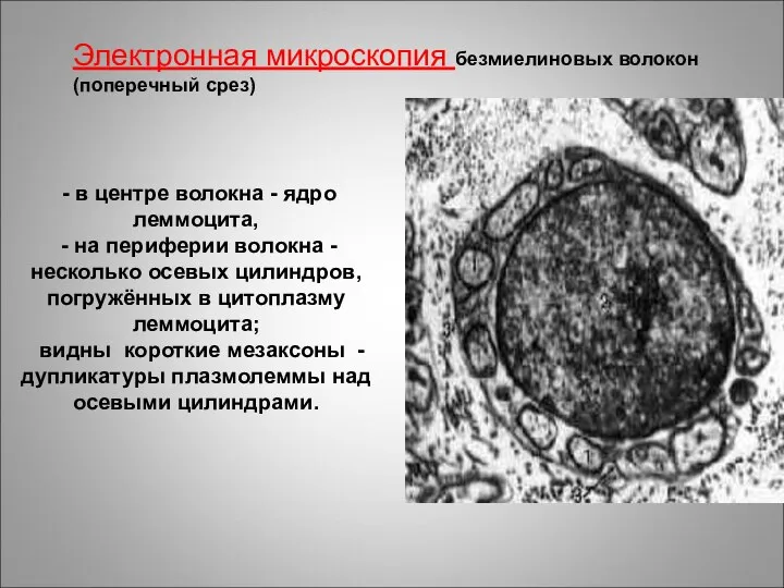 - в центре волокна - ядро леммоцита, - на периферии волокна