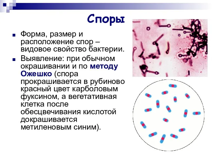 Споры Форма, размер и расположение спор – видовое свойство бактерии. Выявление: