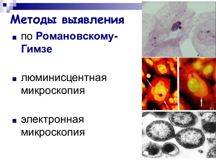 Методы выявления по Романовскому-Гимзе люминисцентная микроскопия электронная микроскопия