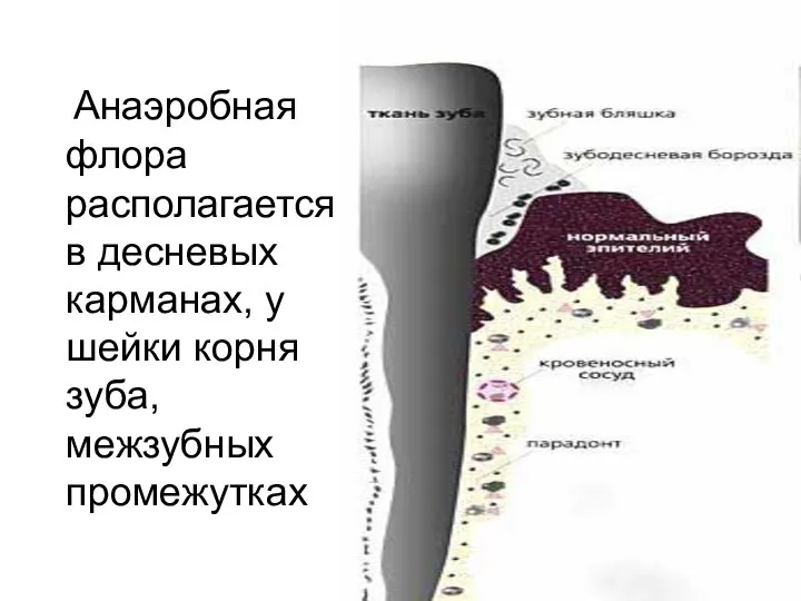 Анаэробная флора располагается в десневых карманах, у шейки корня зуба, межзубных промежутках