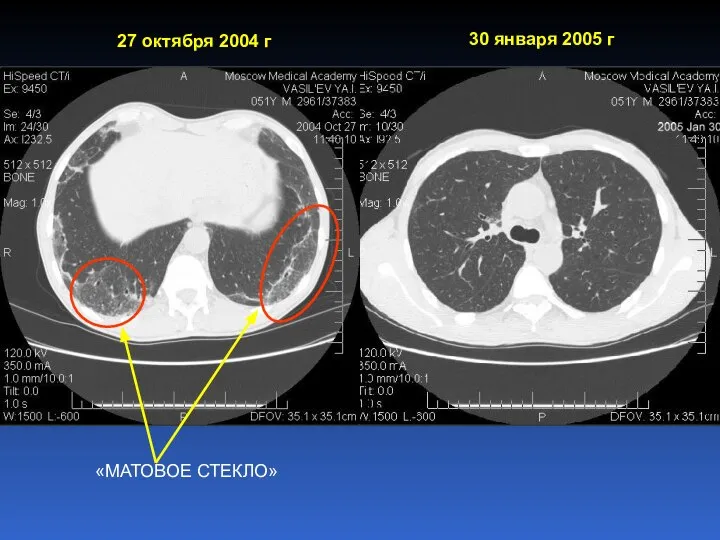 «МАТОВОЕ СТЕКЛО» 27 октября 2004 г 30 января 2005 г