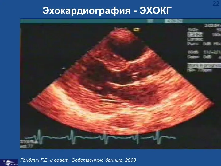 Эхокардиография - ЭХОКГ Гендлин Г.Е. и соавт, Собственные данные, 2008