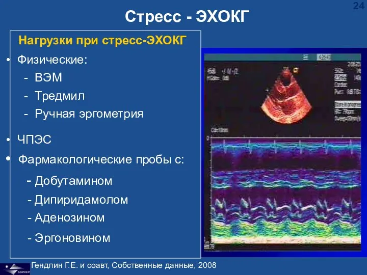 Стресс - ЭХОКГ Гендлин Г.Е. и соавт, Собственные данные, 2008 Нагрузки