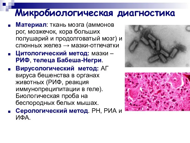Микробиологическая диагностика Материал: ткань мозга (аммонов рог, мозжечок, кора больших полушарий