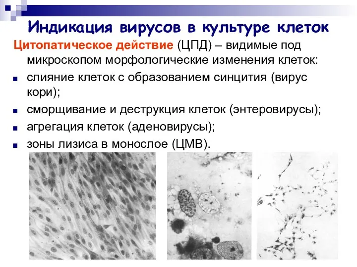 Индикация вирусов в культуре клеток Цитопатическое действие (ЦПД) – видимые под