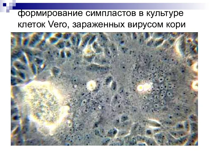 формирование симпластов в культуре клеток Vero, зараженных вирусом кори
