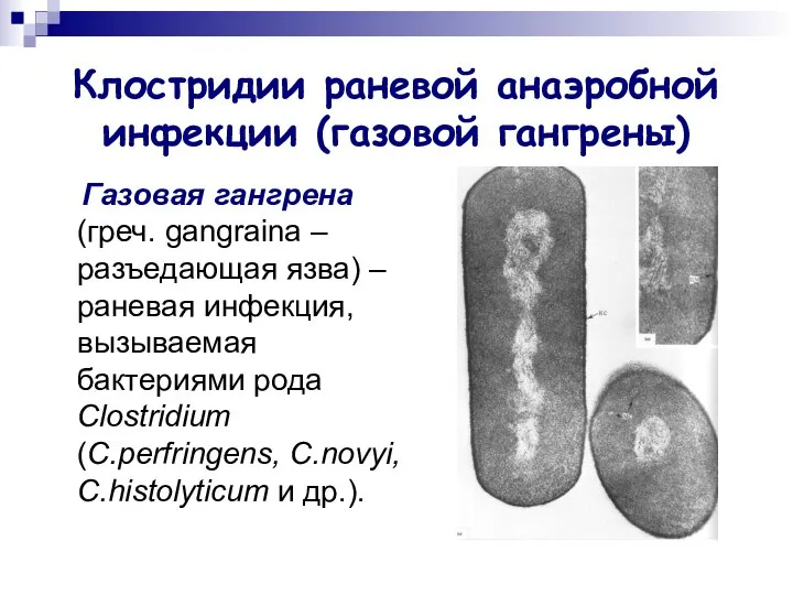 Клостридии раневой анаэробной инфекции (газовой гангрены) Газовая гангрена (греч. gangraina –