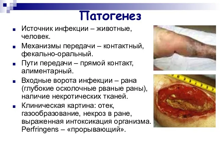 Патогенез Источник инфекции – животные, человек. Механизмы передачи – контактный, фекально-оральный.