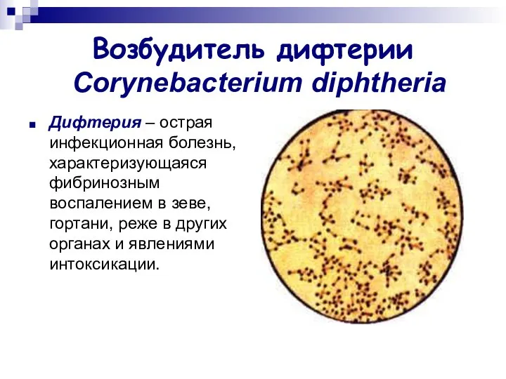 Возбудитель дифтерии Corynebacterium diphtheria Дифтерия – острая инфекционная болезнь, характеризующаяся фибринозным