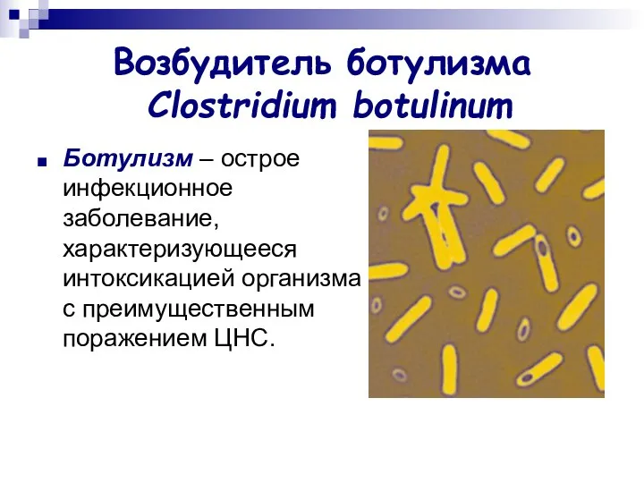 Возбудитель ботулизма Clostridium botulinum Ботулизм – острое инфекционное заболевание, характеризующееся интоксикацией организма с преимущественным поражением ЦНС.