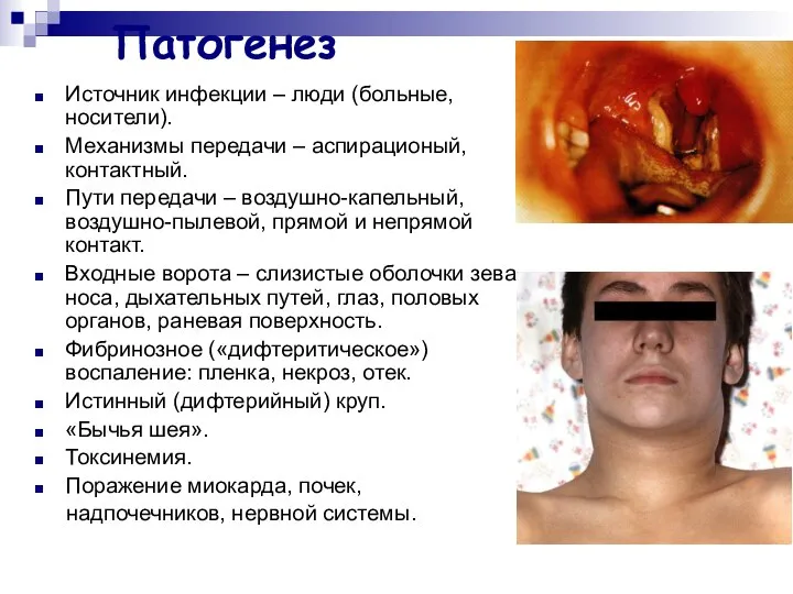 Патогенез Источник инфекции – люди (больные, носители). Механизмы передачи – аспирационый,