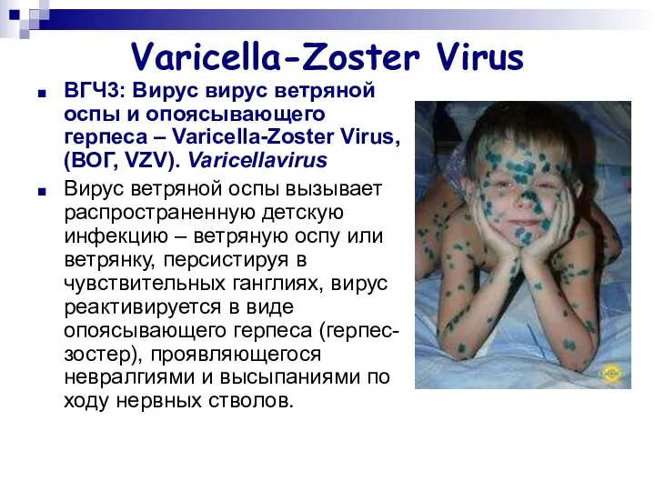 Varicella-Zoster Virus ВГЧ3: Вирус вирус ветряной оспы и опоясывающего герпеса –