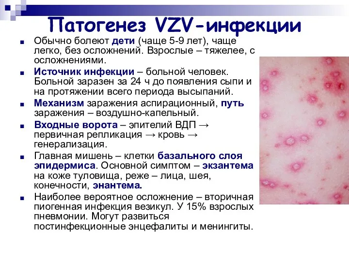 Патогенез VZV-инфекции Обычно болеют дети (чаще 5-9 лет), чаще легко, без