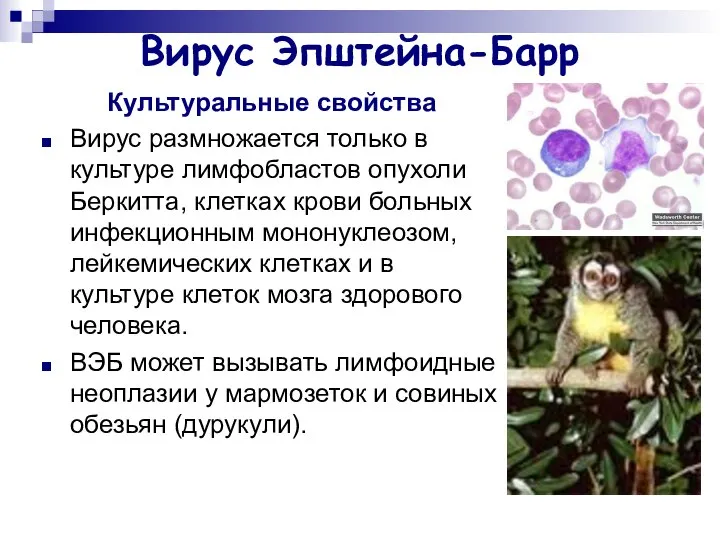 Вирус Эпштейна-Барр Культуральные свойства Вирус размножается только в культуре лимфобластов опухоли