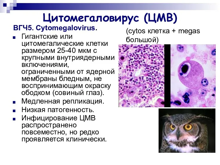 Цитомегаловирус (ЦМВ) ВГЧ5. Cytomegalovirus. Гигантские или цитомегалические клетки размером 25-40 мкм