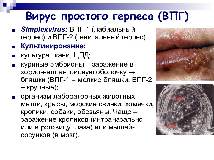 Вирус простого герпеса (ВПГ) Simplexvirus: ВПГ-1 (лабиальный герпес) и ВПГ-2 (генитальный