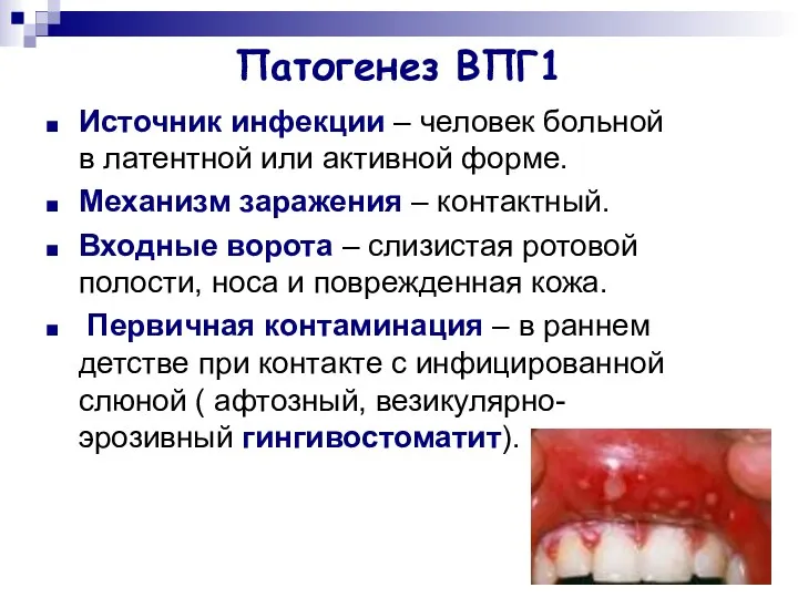 Патогенез ВПГ1 Источник инфекции – человек больной в латентной или активной