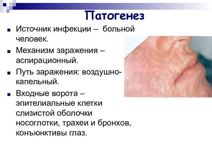 Патогенез Источник инфекции – больной человек. Механизм заражения – аспирационный. Путь