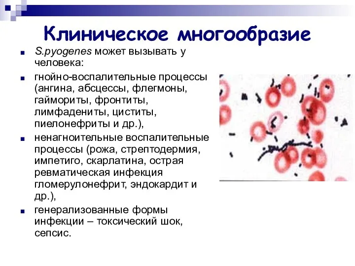 Клиническое многообразие S.pyogenes может вызывать у человека: гнойно-воспалительные процессы (ангина, абсцессы,