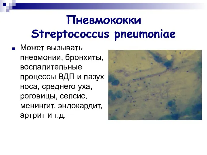 Пневмококки Streptococcus pneumoniae Может вызывать пневмонии, бронхиты, воспалительные процессы ВДП и