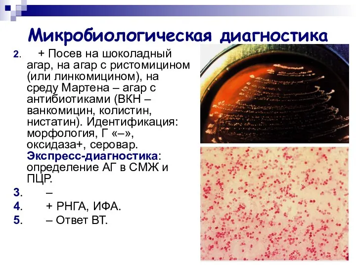 Микробиологическая диагностика 2. + Посев на шоколадный агар, на агар с