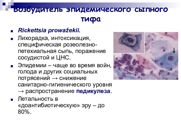 Возбудитель эпидемического сыпного тифа Rickettsia prowažekii. Лихорадка, интоксикация, специфическая розеолезно-петехиальная сыпь,