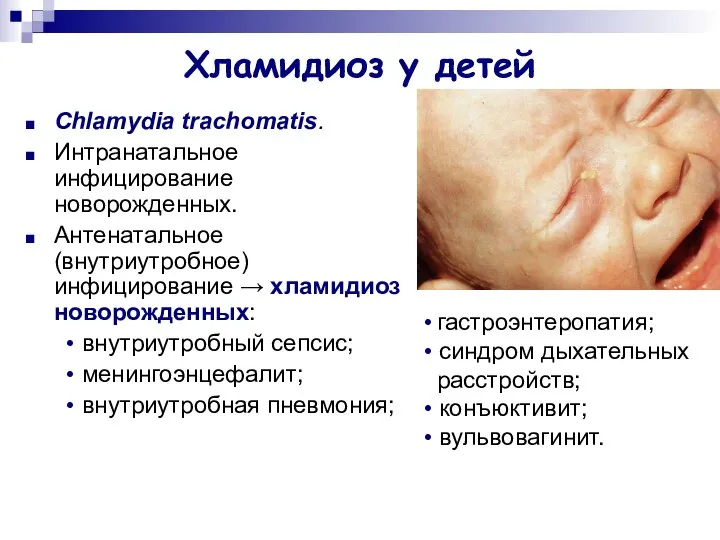 Хламидиоз у детей Chlamydia trachomatis. Интранатальное инфицирование новорожденных. Антенатальное (внутриутробное) инфицирование