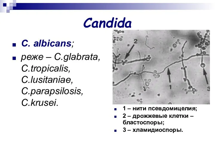 Candida C. аlbicans; реже – C.glabrata, C.tropicalis, C.lusitaniae, C.parapsilosis, C.krusei. 1