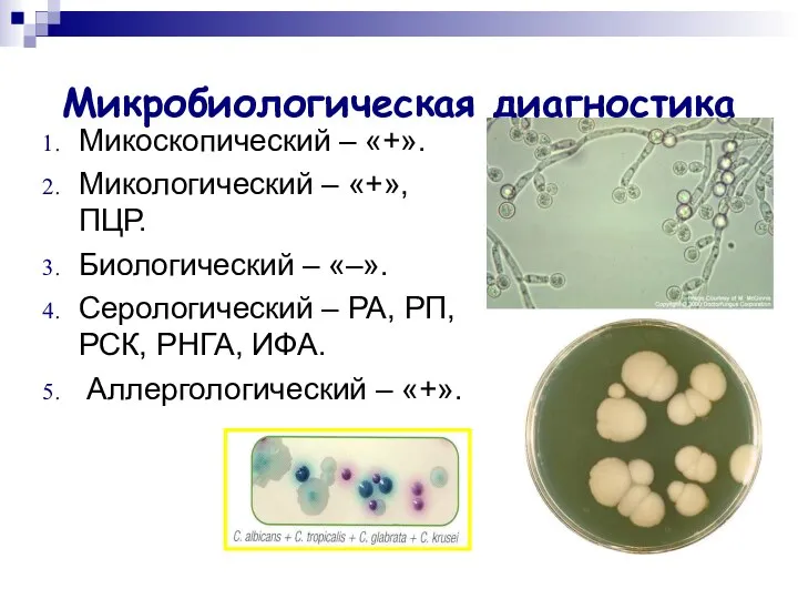 Микробиологическая диагностика Микоскопический – «+». Микологический – «+», ПЦР. Биологический –