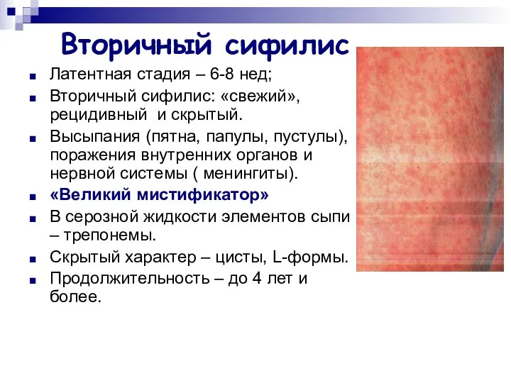 Вторичный сифилис Латентная стадия – 6-8 нед; Вторичный сифилис: «свежий», рецидивный