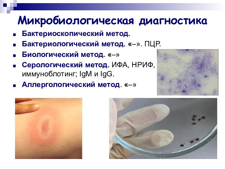 Микробиологическая диагностика Бактериоскопический метод. Бактериологический метод. «–». ПЦР. Биологический метод. «–»