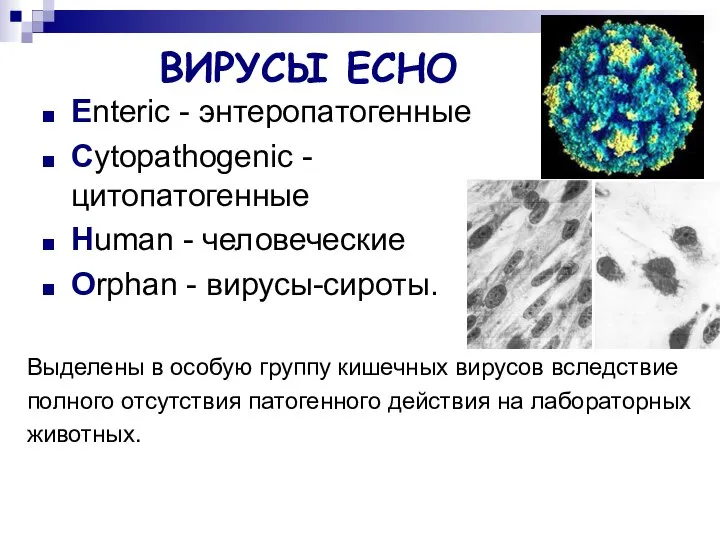 ВИРУСЫ ЕСНО Enteric - энтеропатогенные Cytopathogenic - цитопатогенные Human - человеческие