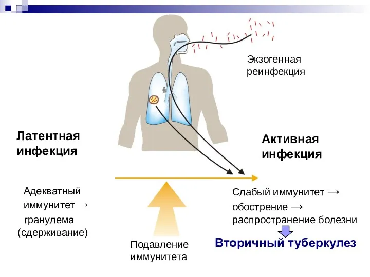 Экзогенная реинфекция Слабый иммунитет → обострение → распространение болезни Латентная инфекция