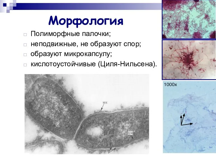 Морфология Полиморфные палочки; неподвижные, не образуют спор; образуют микрокапсулу; кислотоустойчивые (Циля-Нильсена).