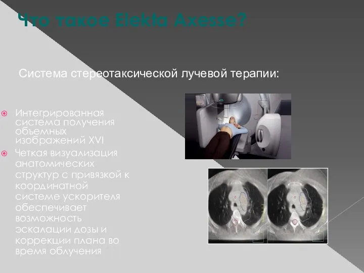 Интегрированная система получения объемных изображений XVI Четкая визуализация анатомических структур с