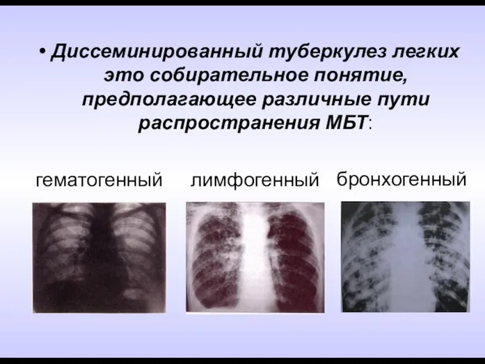 Диссеминированный туберкулез легких это собирательное понятие, предполагающее различные пути распространения МБТ: лимфогенный бронхогенный гематогенный