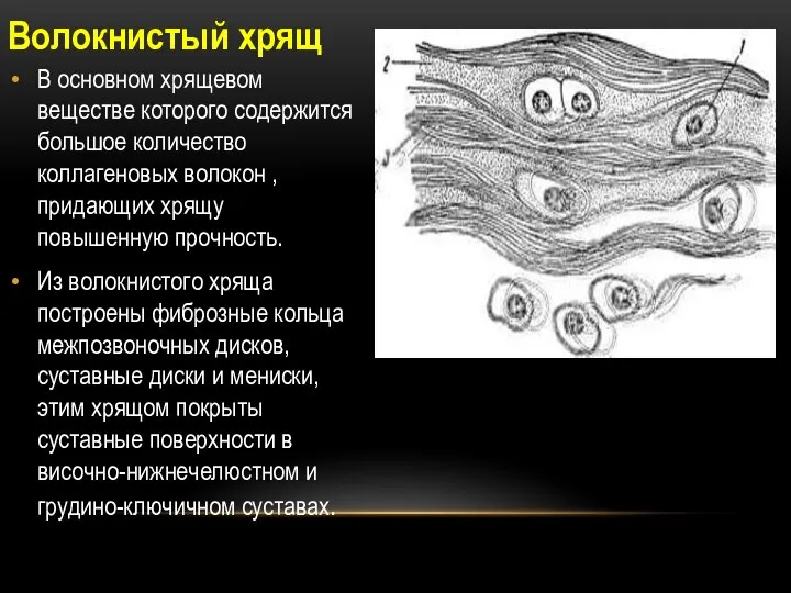 Волокнистый хрящ В основном хрящевом веществе которого содержится большое количество коллагеновых