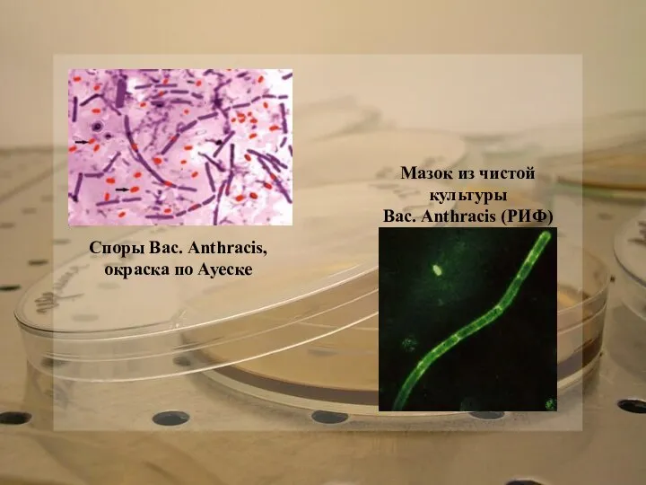 Споры Вас. Anthracis, окраска по Ауеске Мазок из чистой культуры Вас. Anthracis (РИФ)