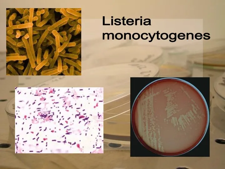 Listeria monocytogenes