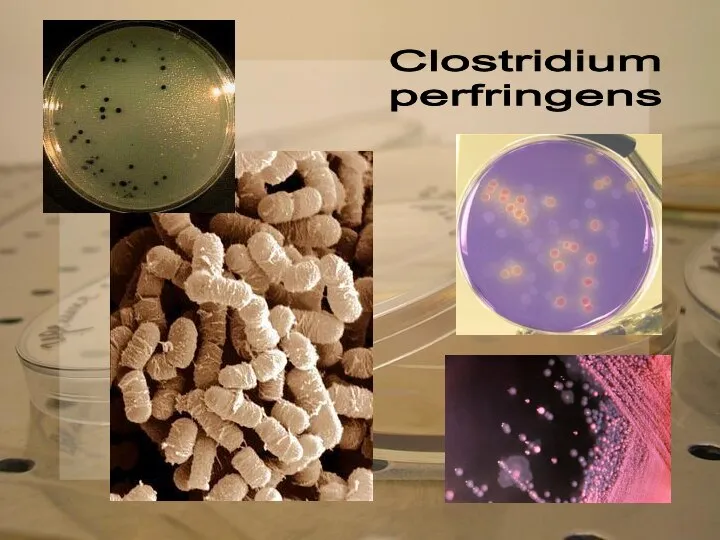 Clostridium perfringens