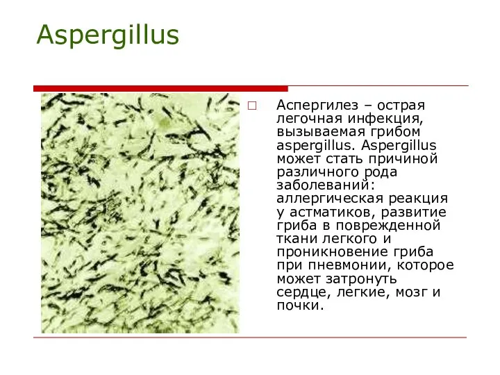 Aspergillus Аспергилез – острая легочная инфекция, вызываемая грибом aspergillus. Aspergillus может