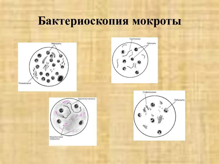 Бактериоскопия мокроты