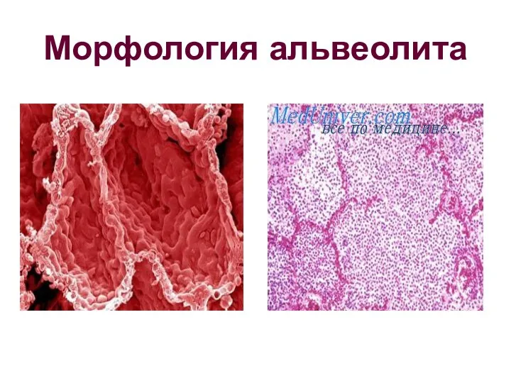 Морфология альвеолита