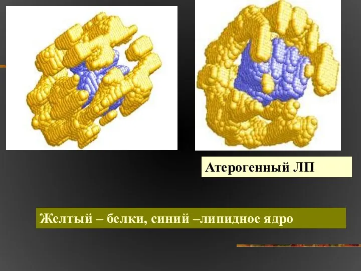 Атерогенный ЛП Желтый – белки, синий –липидное ядро