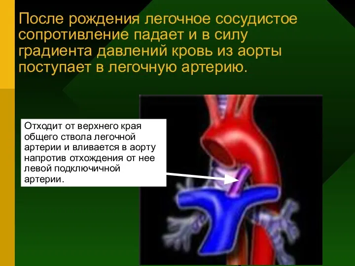 После рождения легочное сосудистое сопротивление падает и в силу градиента давлений