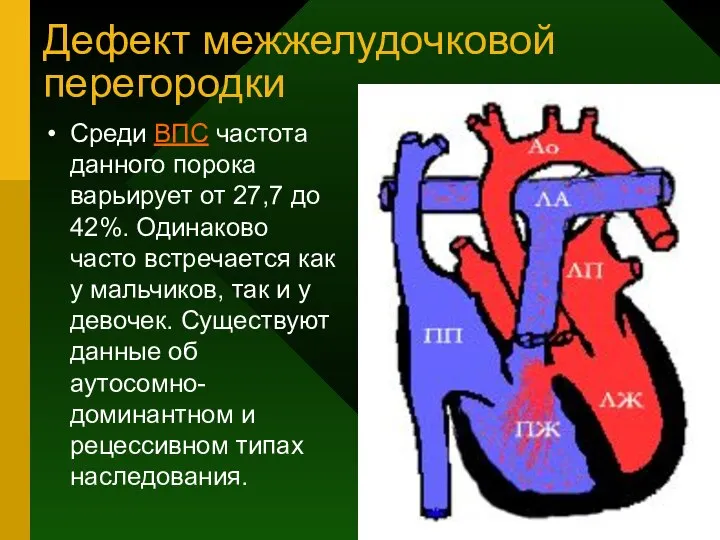 Дефект межжелудочковой перегородки Среди ВПС частота данного порока варьирует от 27,7